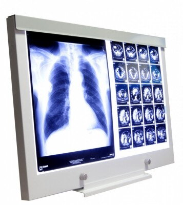 Negatoskop LED NGP-21 SLIM, 2 panelový nástenný