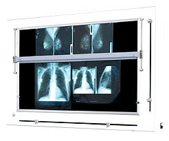 Negatoskop pre mammograms (s clonou) NGP 41m ZU