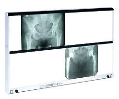 NGP-600 HF (bez úpravy jasu)