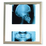 Negatoskop LED NGP-11 SLIM, 1 panelový  nástenný